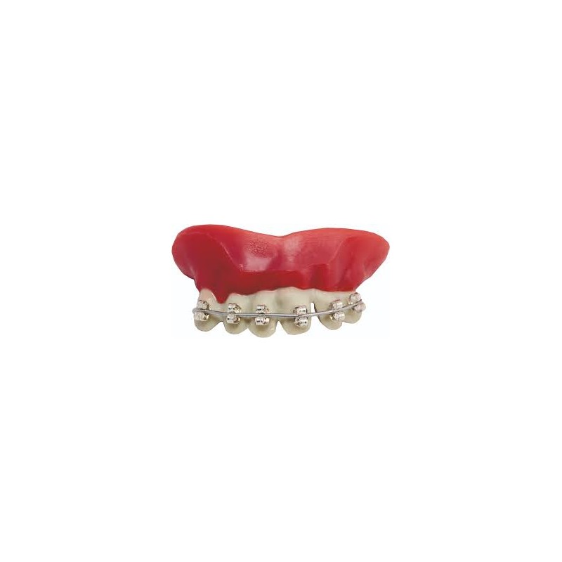 DENTIER APPAREIL DENTAIRE DENTIER APPAREIL DENTAIRE
